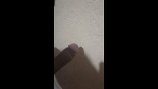 Circuncisión Proceso