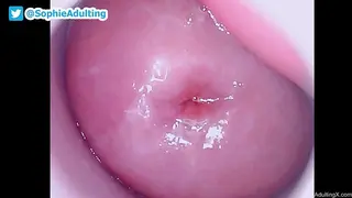 My Happy Pink Small Cervix