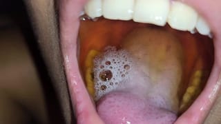 My Piss Deposit Swallow very Yellow Piss 7/22/2023