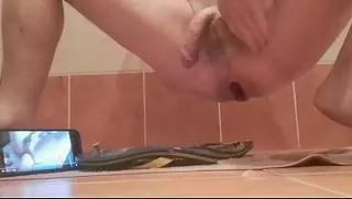Anal flip-flops insertion