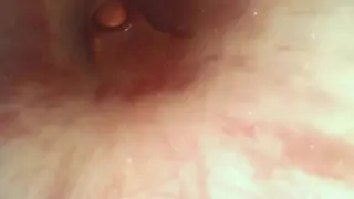Endoscope inside 9mm Tube Estim Urethra to Prostate Orgasm Ejaculation Full Length