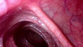 Take in the View Peering up my Descending Colon