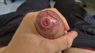 Tight Uncut Phimosis Cock Stretched Close Up! Raw Foreskin Play