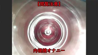 Urethral Masturbation with an Endoscope.