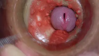 Camera inside Deep Pussy Captures Huge Ejaculation of Sperm 4k