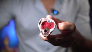 This is how an Erection is Produced – Clear Medical Explanation